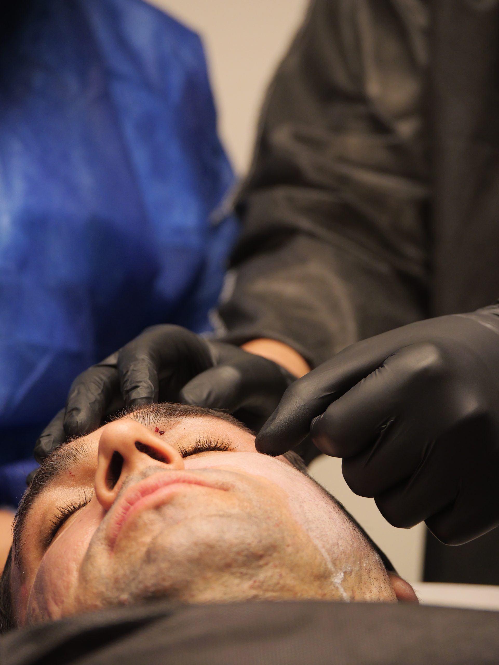Peeling SKIMS - Dr. José Henrique - mentoria - curso - imersao - presencial