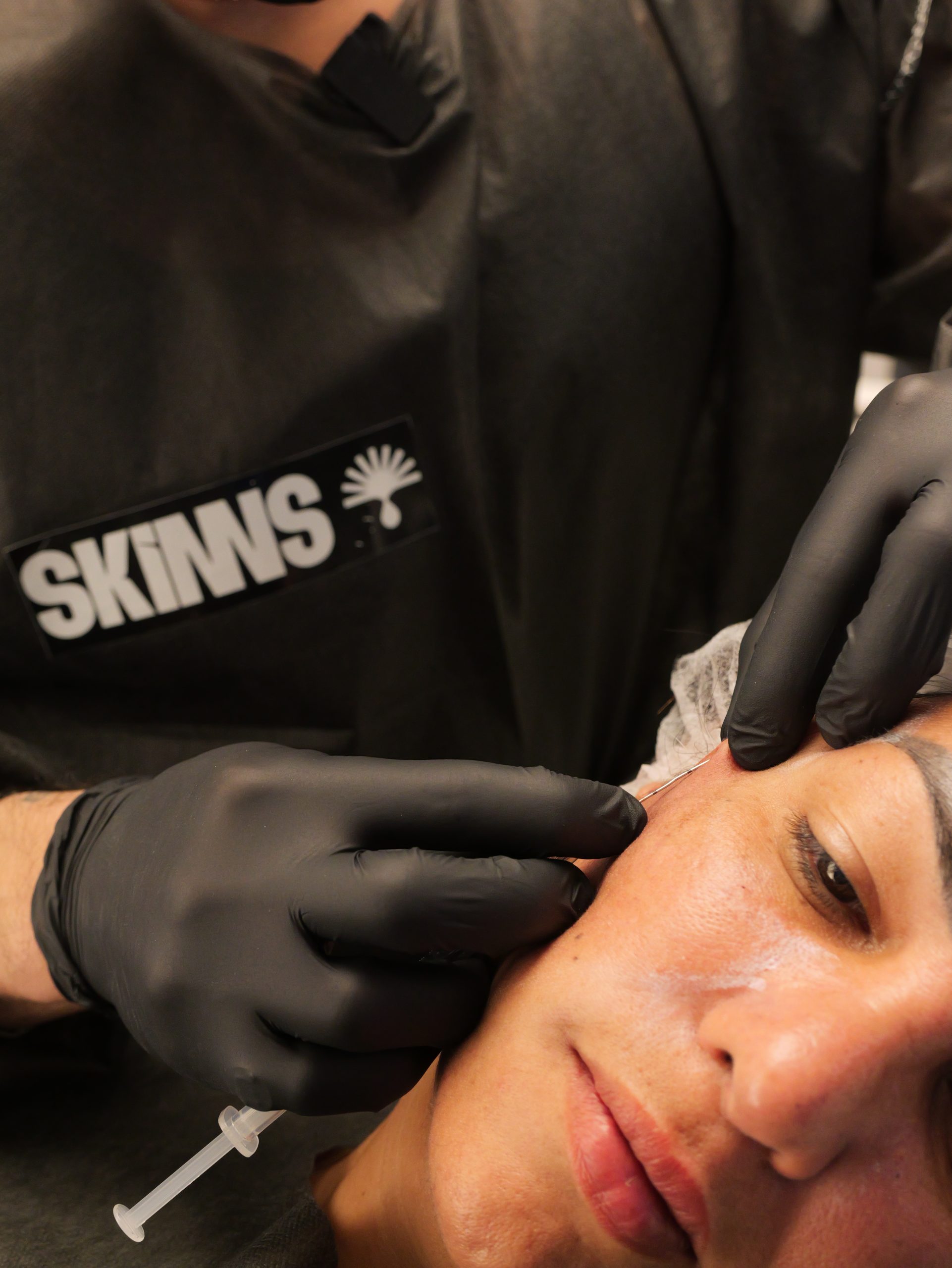Peeling SKIMS - Dr. José Henrique - mentoria - curso - imersao- sp