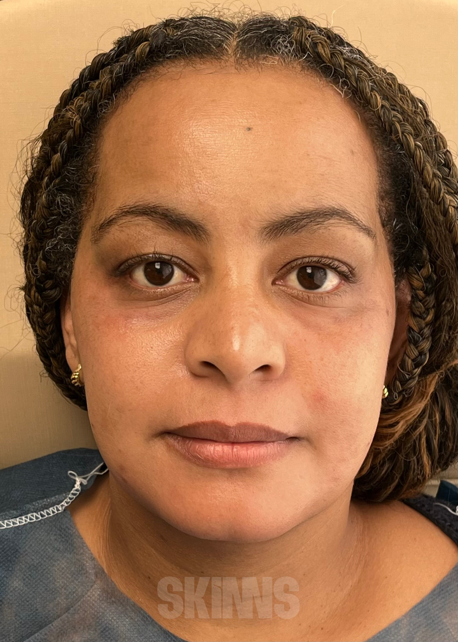 peeling para o rosto SKIMS - Resultados 12