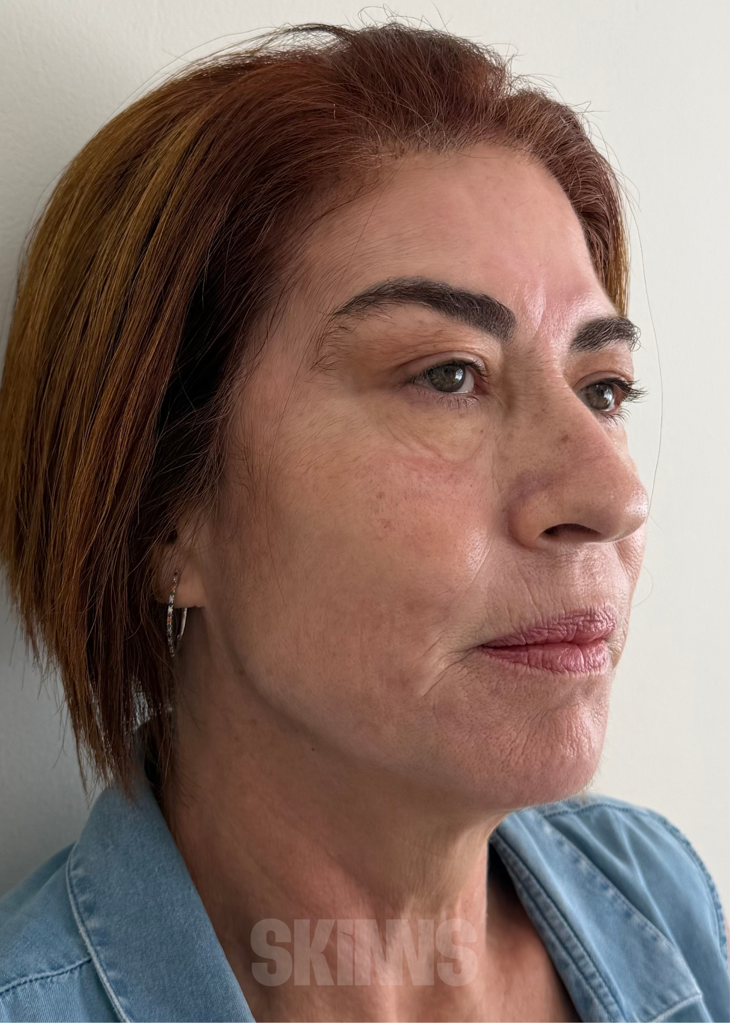 peeling para o rosto SKIMS - Resultados 13