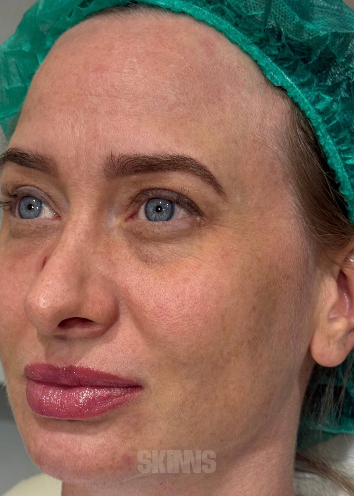 peeling para o rosto SKIMS - Resultados 14