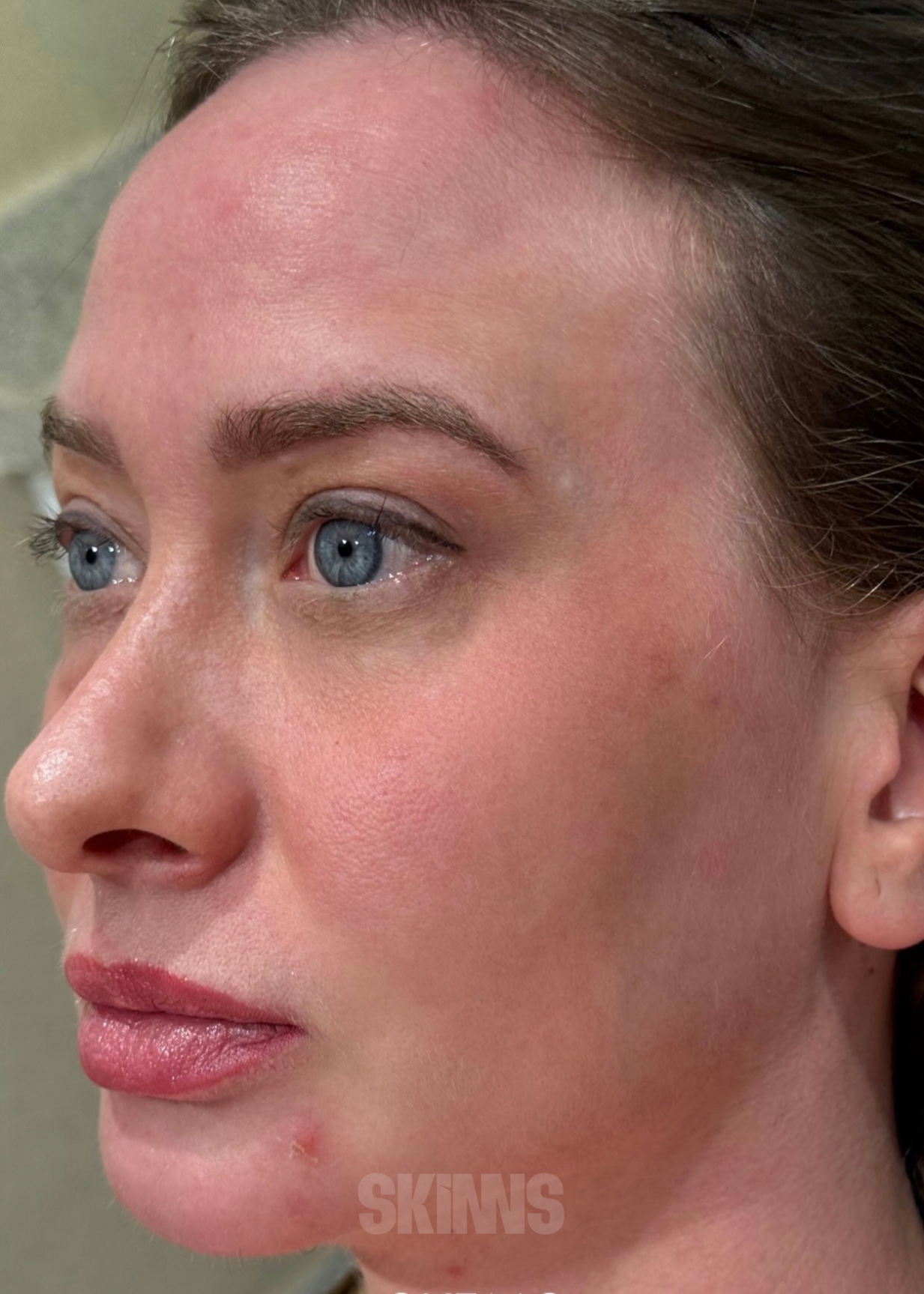 peeling para o rosto SKIMS - Resultados 15