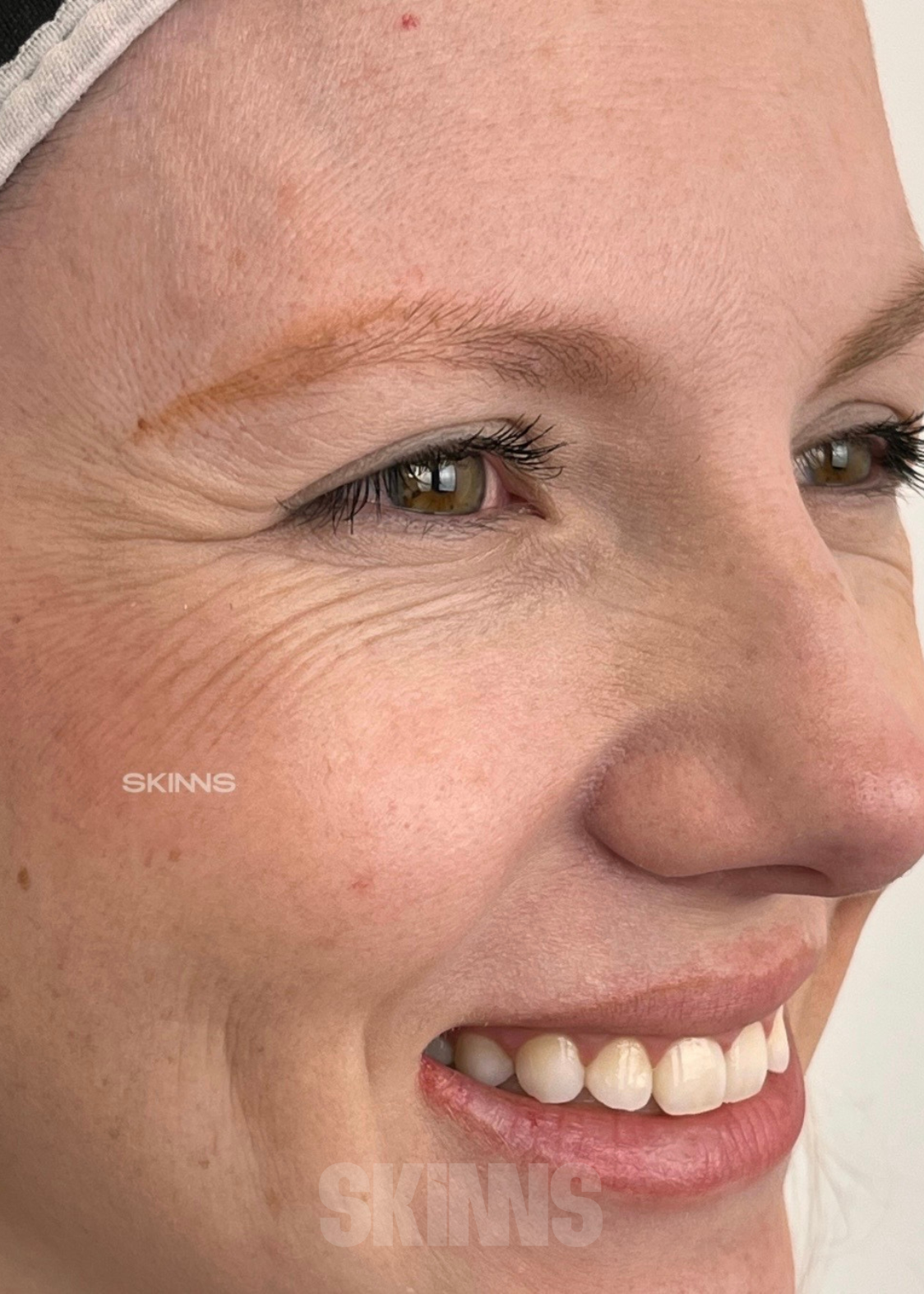 peeling para o rosto SKIMS - Resultados 17