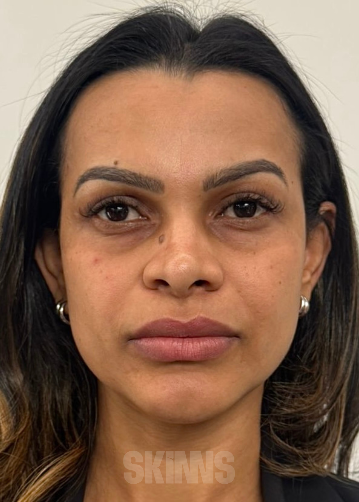 peeling para o rosto SKIMS - Resultados 18