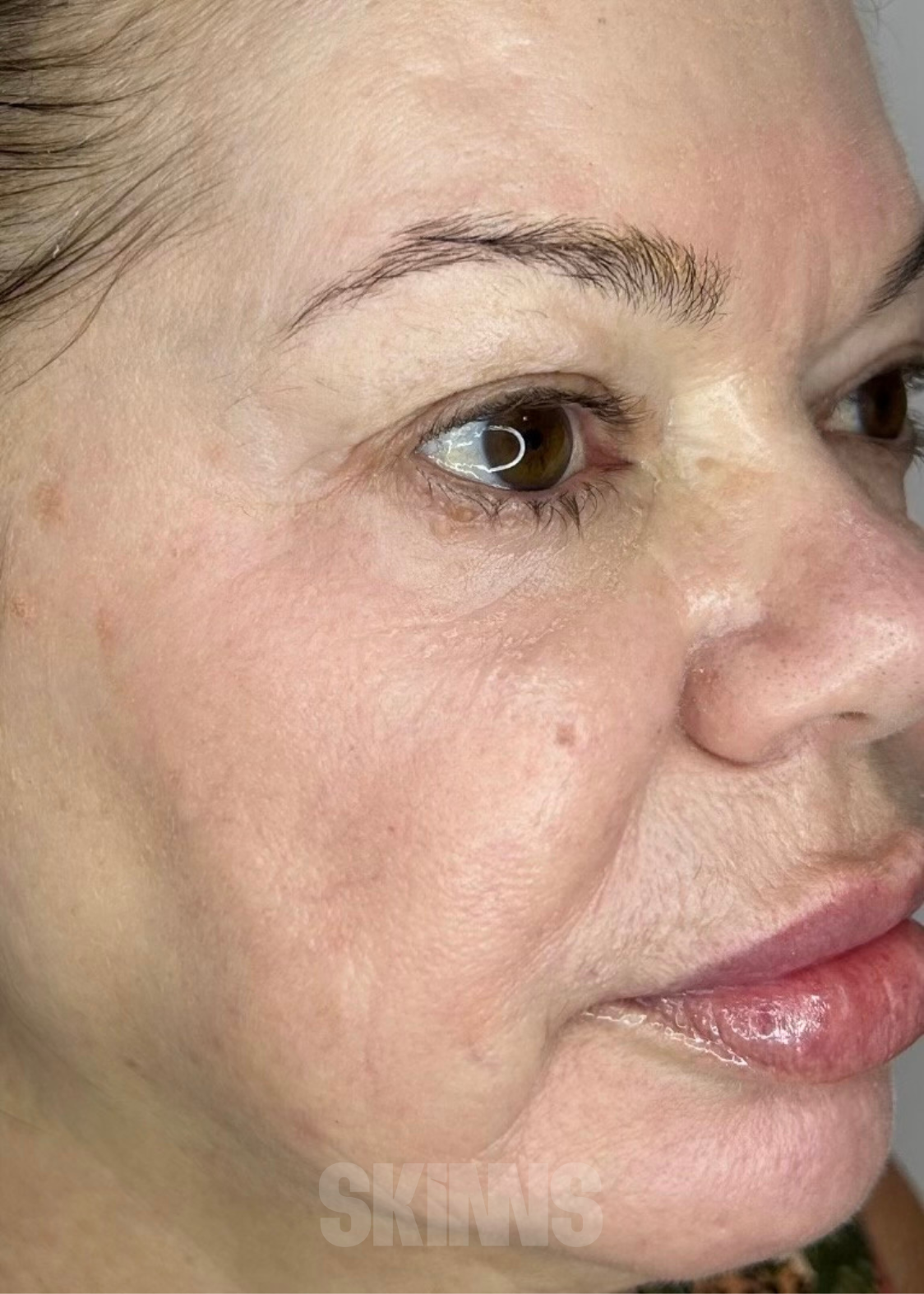 peeling para o rosto SKIMS - Resultados 4