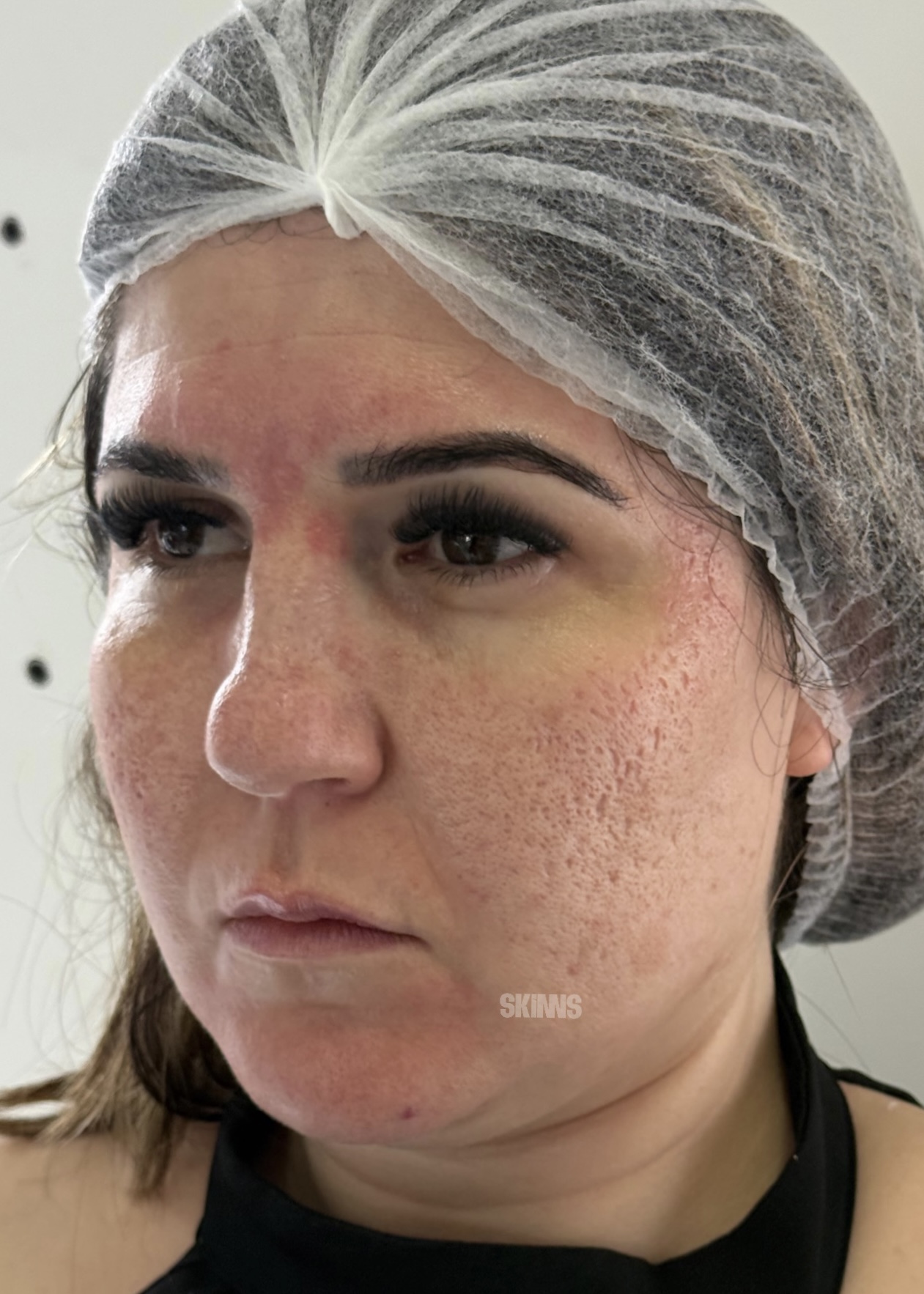 peeling para o rosto SKIMS - Resultados 7