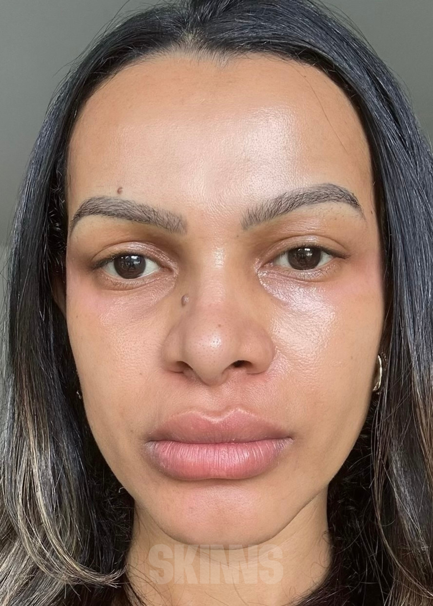 peeling para o rosto SKIMS - Resultados 8