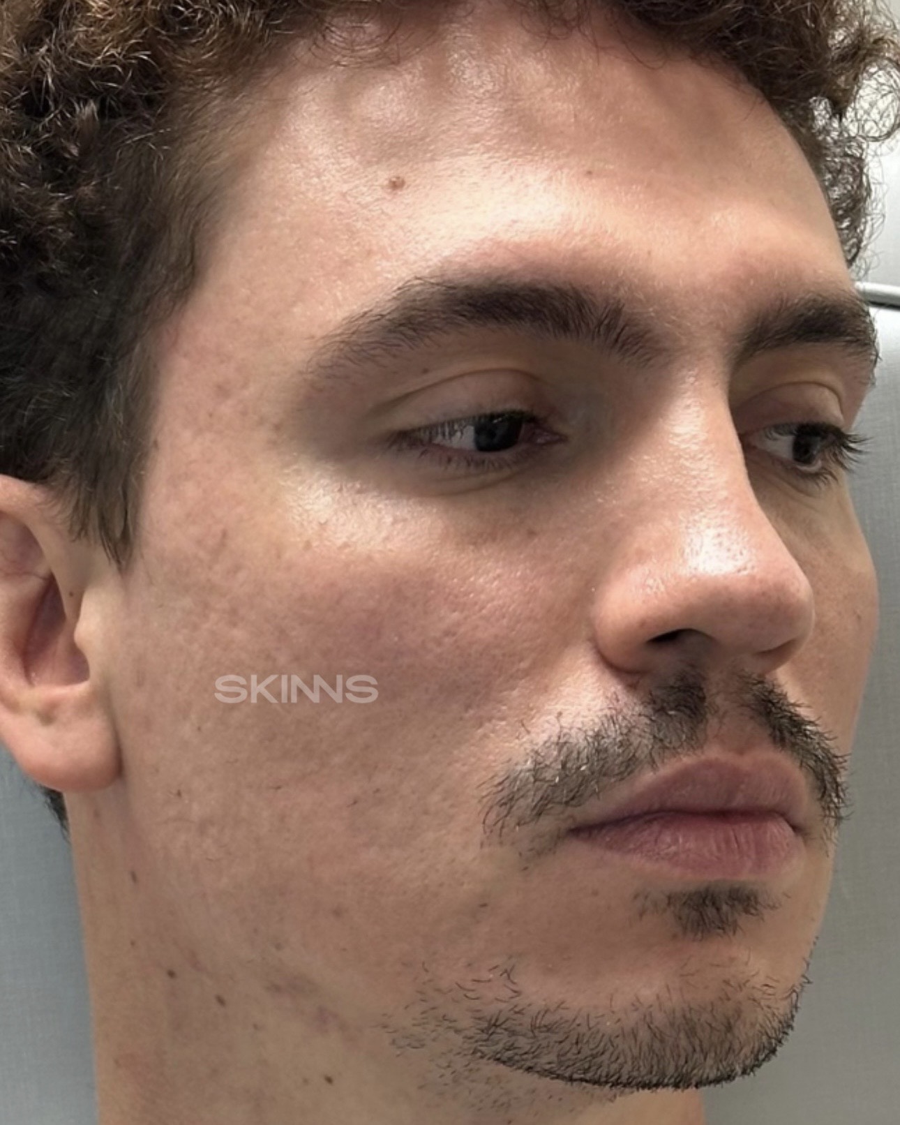peeling para o rosto SKIMS - Resultados10