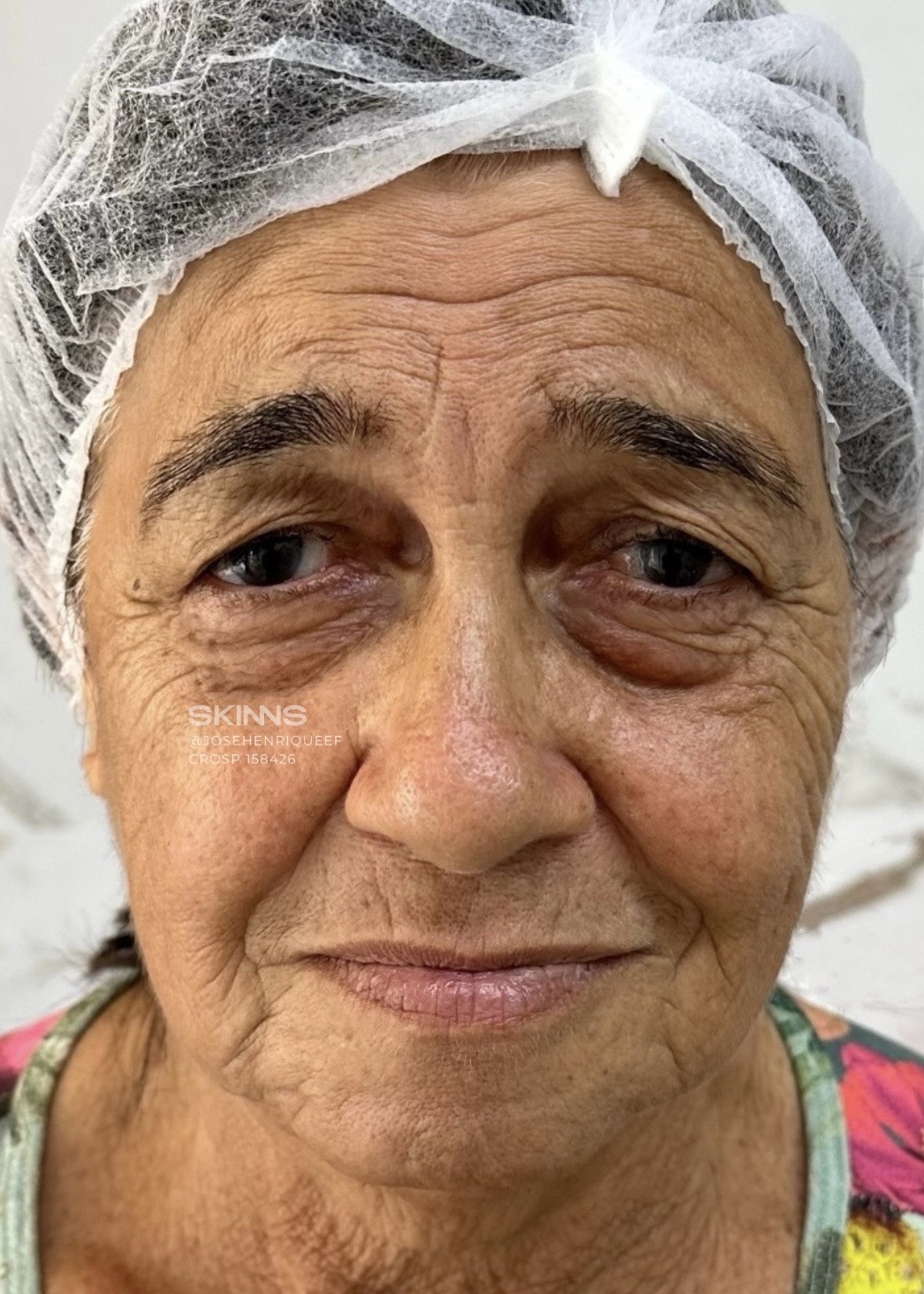 SKIMS Rejuvenescimento: Resultados - 27