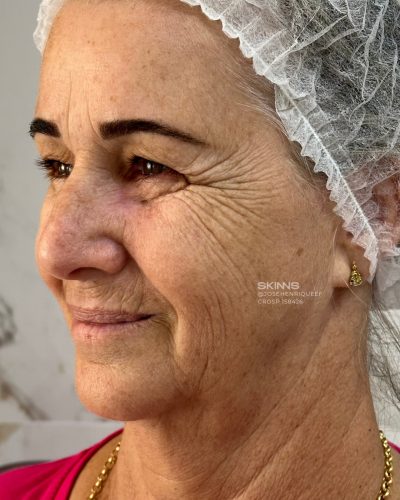 SKIMS-Rejuvenescimento-Resultados.zip-16 SKIMS-Rejuvenescimento-Resultados.zip-16